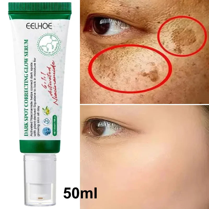 Dark Spots Remover Whitening Serum Face Freckle Melanin Correcting Anti Pigmentation Brightening Korean Day Night Skin Care 50ml