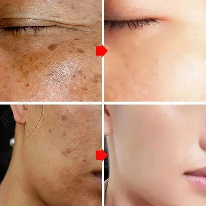 Suero de niacinamida Corrector de manchas oscuras Hidratante Iluminador Atenúa líneas finas Limpieza profunda Desmaquillante Cuidado de la piel coreano