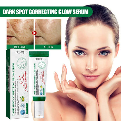 Dark Spots Remover Whitening Serum Face Freckle Melanin Correcting Anti Pigmentation Brightening Korean Day Night Skin Care 50ml