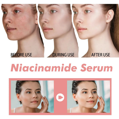 Suero de niacinamida Corrector de manchas oscuras Hidratante Iluminador Atenúa líneas finas Limpieza profunda Desmaquillante Cuidado de la piel coreano