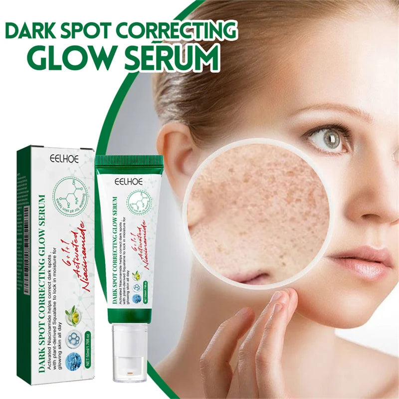 Dark Spots Remover Whitening Serum Face Freckle Melanin Correcting Anti Pigmentation Brightening Korean Day Night Skin Care 50ml